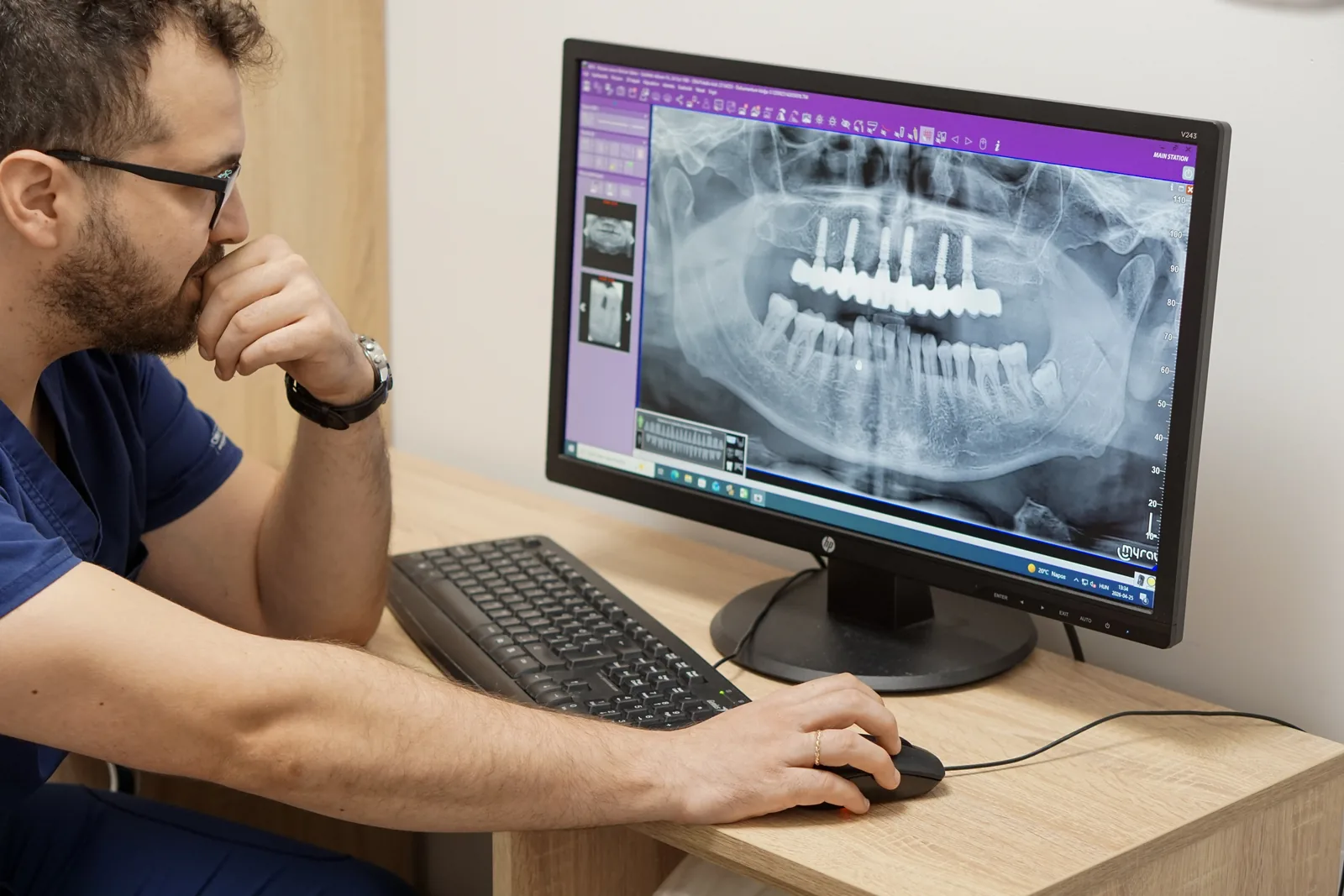 Fogimplantátum tervezése röntgen és digitális diagnosztika alapján
