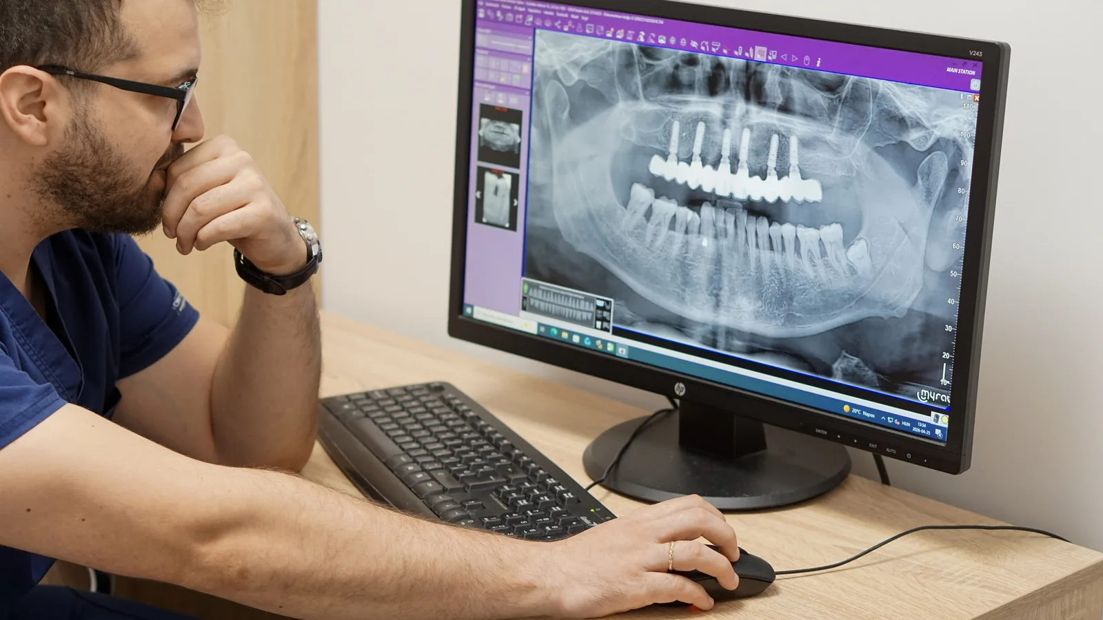 Fogpótlási konzultáció implantátum vagy foghíd döntés előtt