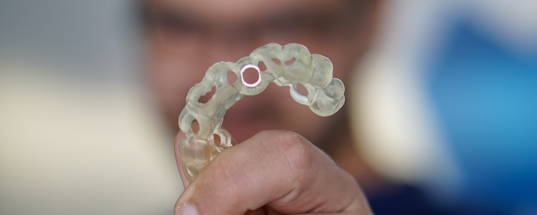 Fogimplantátum tervezése és sebészi sablon Dentist For You rendelőben