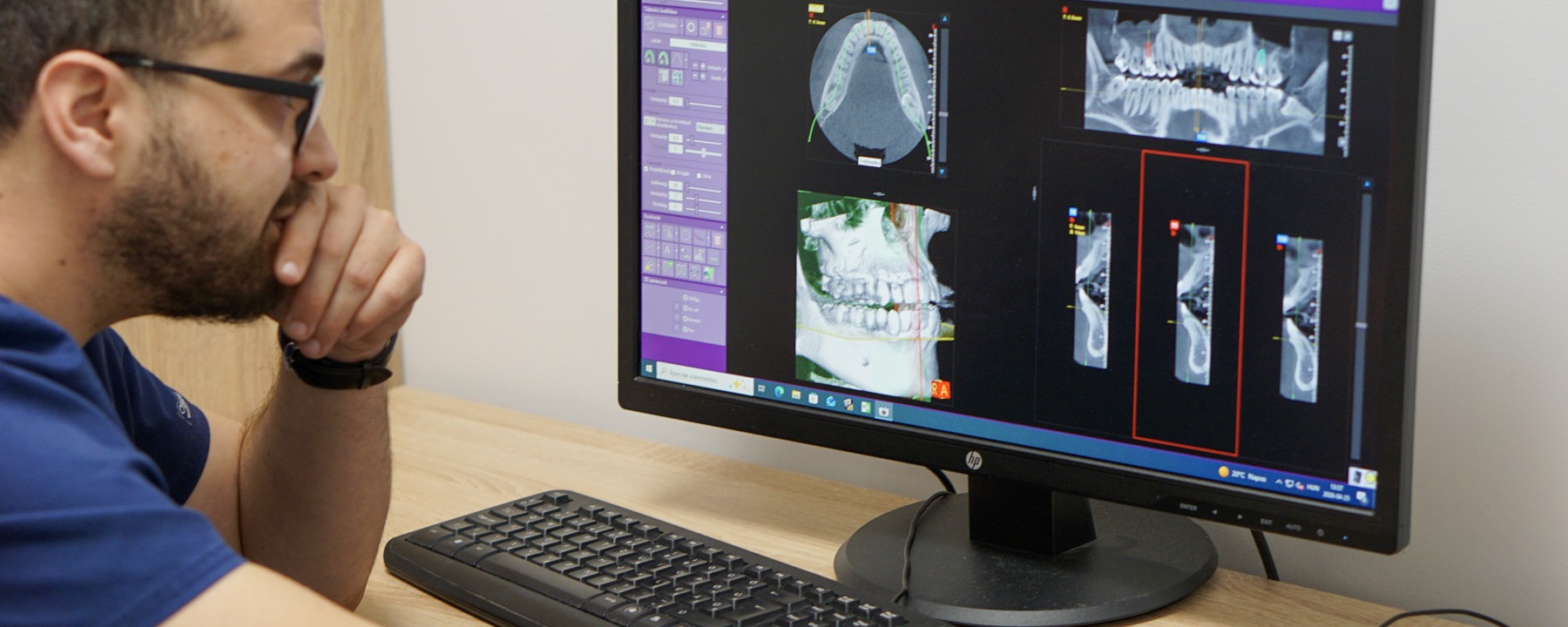 Digitális fogpótlás tervezés és diagnosztika Dentist For You rendelőben